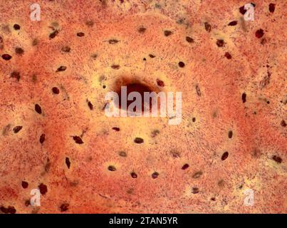 Human compact bone tissue, light micrograph Stock Photo