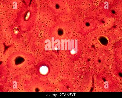 Human compact bone tissue, light micrograph Stock Photo