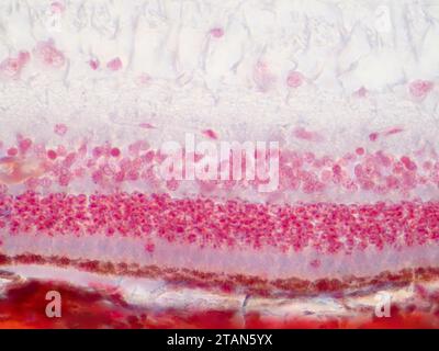 Human retina tissue, light micrograph Stock Photo