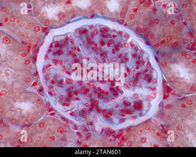 Human kidney, light micrograph Stock Photo