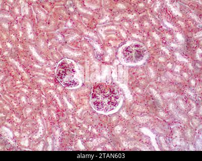 Human kidney, light micrograph Stock Photo