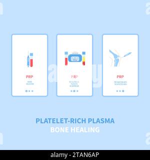 Platelet-rich plasma, conceptual illustration Stock Photo