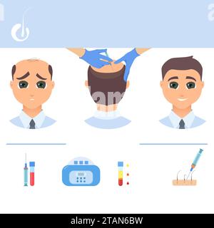 PRP for hair loss treatment, conceptual illustration Stock Photo