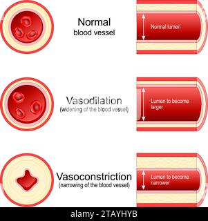 Cross section of artery. Blood vessel anatomy Stock Vector Image & Art ...