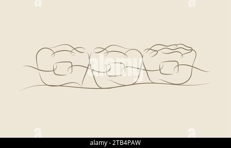 Teeth braces illustration drawing in linear style on beige color background Stock Vector