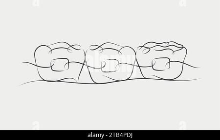 Teeth braces illustration drawing in linear style on white color background Stock Vector