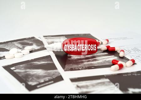 Medical concept. On the ultrasound pictures there are pills and a pen with the inscription - Dysbacteriosis Stock Photo