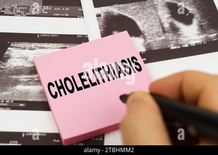 Medical concept. On the ultrasound pictures there are stickers that say - Cholelithiasis Stock Photo