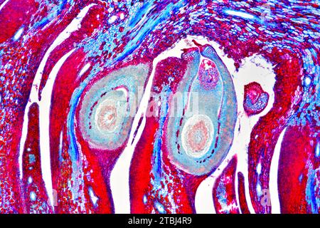 Female cone of pine (Pinus sp.) showing ovules. Optical microscope X40. Stock Photo