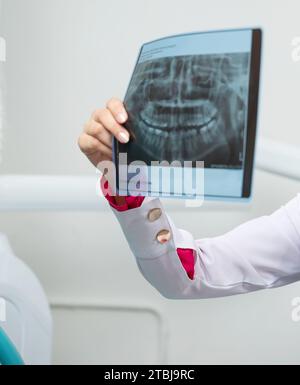 Xray photo of human teeth in hand of doctor close up view Stock Photo