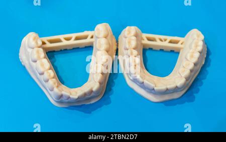 lower jaw of a man created on a 3d printer Stock Photo