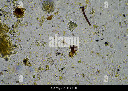 microscopic microorganisms under the microscope Stock Photo - Alamy