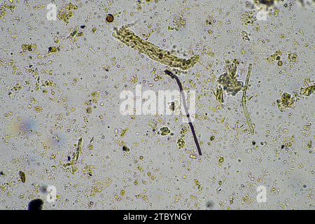 soil microbes under the microscope. microorganisms with fungus in ...