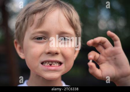 6 years old boy shows the ruptured milk tooth Stock Photo