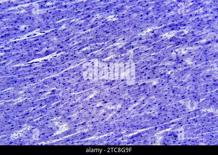 Cardiac muscle showing myocytes. Light microscope X150 at 10 cm wide. Stock Photo