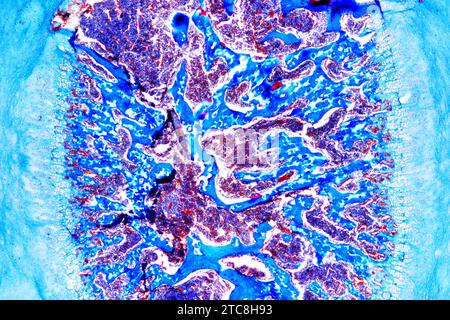 Cancellous or spongy bone is an hematopoietic organ. Light microscope X40 at 10 cm wide. Stock Photo