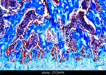 Cancellous or spongy bone is an hematopoietic organ. Light microscope X150 at 10 cm wide. Stock Photo