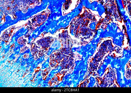 Cancellous or spongy bone is an hematopoietic organ. Light microscope X150 at 10 cm wide. Stock Photo