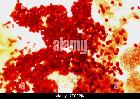 Common liver fluke (Fasciola hepatica or Distomum hepaticum) eggs. Light microscope X50 at 10 cm wide. Stock Photo