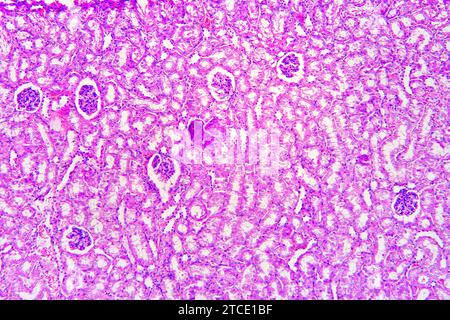 Kidney section showing nephrons, Bowman capsules, glomerulus and distal and proximal tubules. Optical microscope X100. Stock Photo