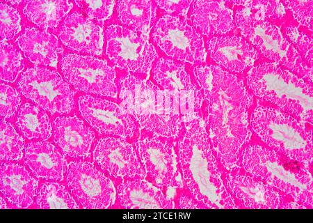 Human testicle or testis section showing seminiferous tubules, Leydig ...
