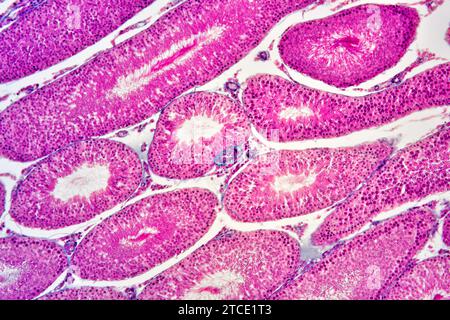 Human testicle or testis section showing seminiferous tubules, Leydig ...