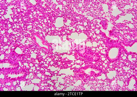 Human lung section showing alveoli, bronchiole and blood vessel. Optical microscope X100. Stock Photo