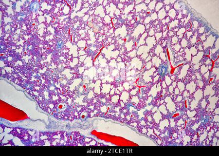 Human lung section showing alveoli, bronchiole and blood vessels. Optical microscope X100. Stock Photo