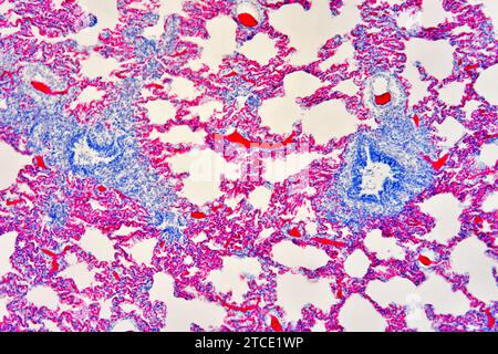 Human lung section showing alveoli, bronchiole and blood vessels. Optical microscope X100. Stock Photo