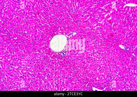 Human healthy or normal liver with hepatocytes and blood vessels. Optical microscope X100. Stock Photo