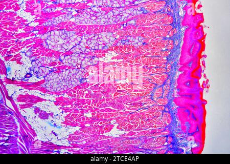 Tongue section showing lingual papillae, taste buds, striated muscles ...