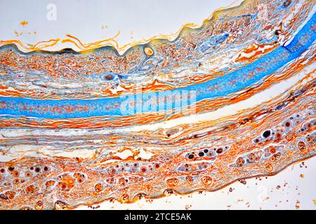 Elastic cartilaginous tissue from the ear showing chondrocytes, elastin ...