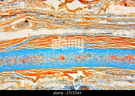 Elastic cartilaginous tissue from the ear showing chondrocytes, elastin ...