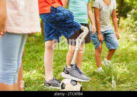 Group of children playing with soccer ball with boy with prosthetic leg in summer Stock Photo