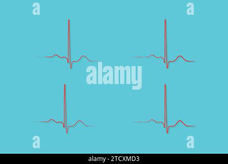 Ventricular repolarization, Cardiac cycle, ECG of heart in normal sinus rhythm, QT interval of ECG. Stock Vector