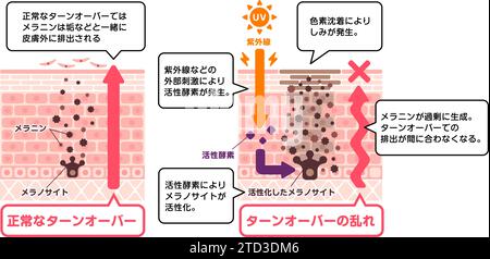 mechanism of skin pigmentation / skin spot illustration Stock Vector ...