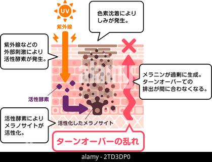mechanism of skin pigmentation / skin spot illustration Stock Vector ...