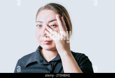 Person with irritated eyes. People with eye pain isolated. woman with conjunctivitis on white background. Close up of girl with eye strain Stock Photo