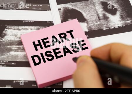 Medical concept. On the ultrasound pictures there are stickers that say - Heart disease Stock Photo