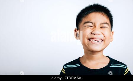 Boy without upper tooth smiles wide showing the gap. Child isolated portrait on white. Dental care Stock Photo