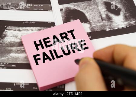 Medical concept. On the ultrasound pictures there are stickers that say - heart failure Stock Photo