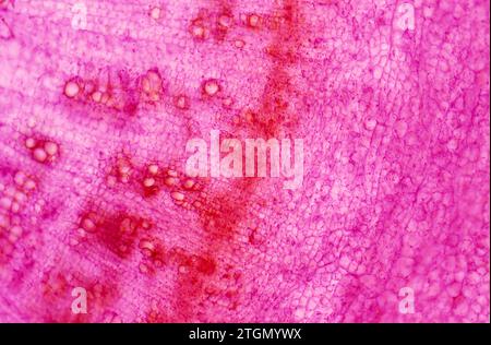 Cambium is a growth tissue of the plants with secondary growth. Is found bettween xylem (left) and phloem (right). Photomicrograph. Stock Photo