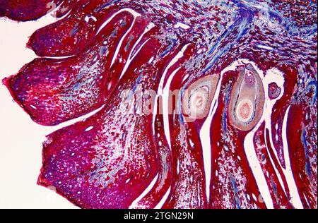 Pine female cone showing ovules. Photomicrograph. Stock Photo