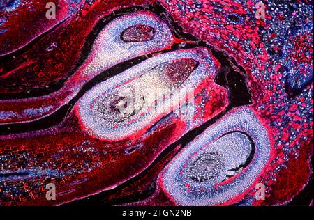 Pine female cone showing ovules. Photomicrograph. Stock Photo