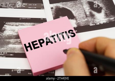 Medical concept. On the ultrasound pictures there are stickers that say - Hepatitis Stock Photo