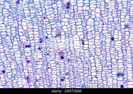 Raphides of calcium oxalate in a plant cellules. Photomicrograph X100 at 10cm wide. Stock Photo