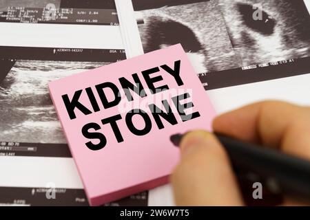 Medical concept. On the ultrasound pictures there are stickers that say - Kidney stone Stock Photo