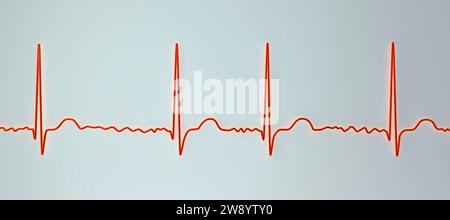 Atrial fibrillation irregular heartbeat rhythm, illustration Stock Photo