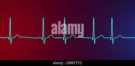 Atrial fibrillation irregular heartbeat rhythm, illustration Stock Photo