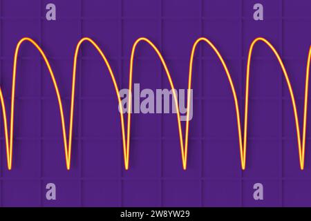 Ventricular tachycardia heartbeat rhythm, illustration Stock Photo